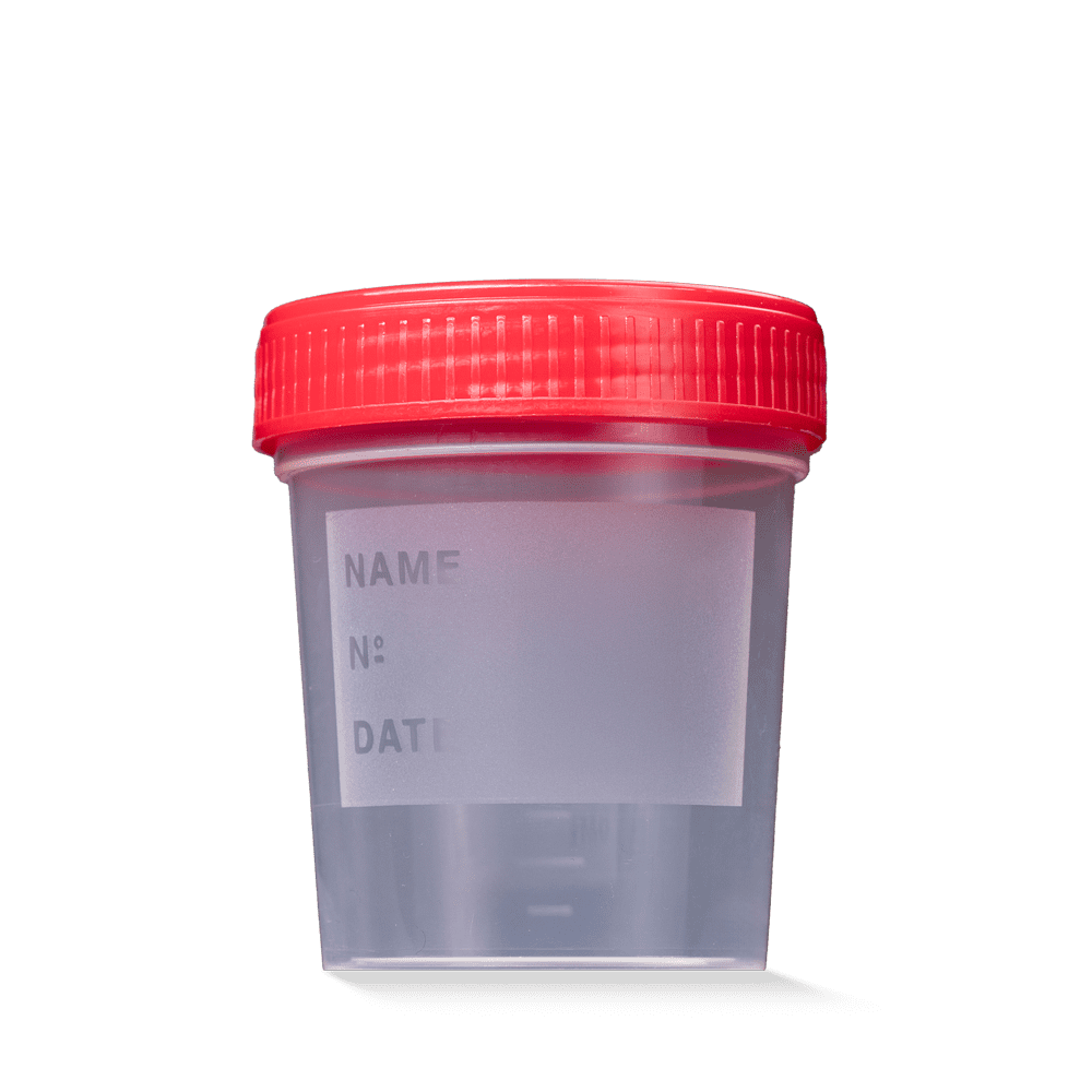 PP universal collection container, sterile, with screw cap, 125 ml, color transparent, milky, red PP universal collection container, sterile, with screw cap, 125 ml, color transparent, milky, red