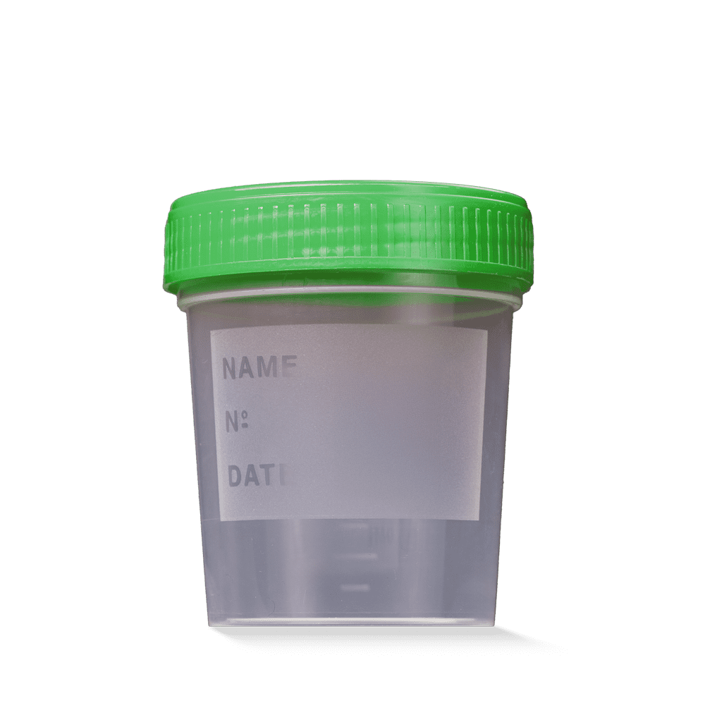 Recipiente de recogida de orina de PP con tapa de rosca, 125 ml, color transparente, verde: comprar vaso de orina graduado para el transporte seguro de la orina como suministro de la sala y del paciente.